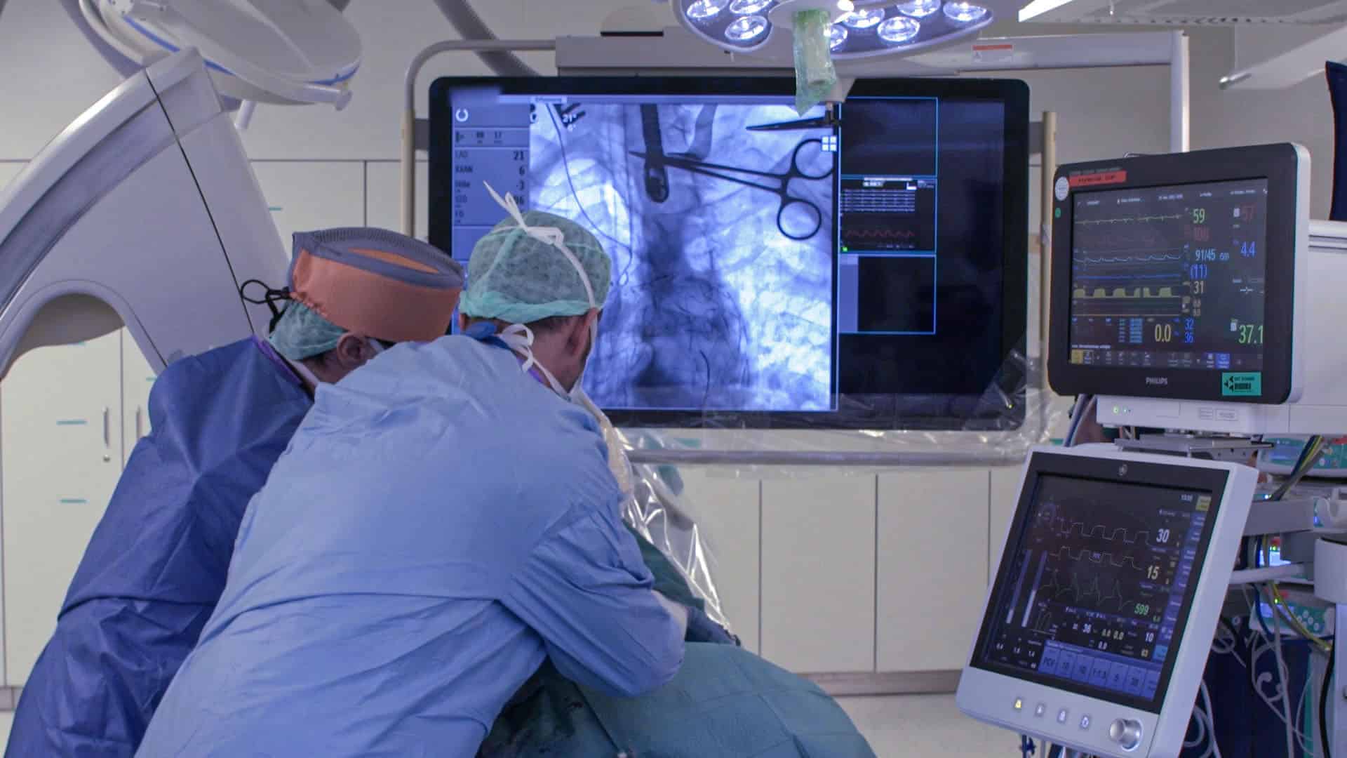 endovaskuläre_versorgung_stent_graft _02 Zwei Chirurgen in OP-Kleidung beugen sich über einen Patienten während einer endovaskulären Operation. Im Hintergrund ist ein großer Monitor mit einem Röntgenbild des Körpers zu sehen, auf dem ein Stent-Graft und chirurgische Instrumente dargestellt sind. Rechts befinden sich mehrere medizinische Überwachungsmonitore mit Vitaldaten.